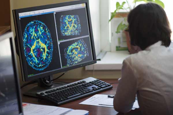 Person reviewing brain scans on her computer