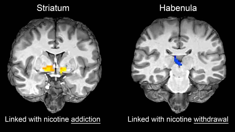 What Does Nicotine Do to the Brain?
