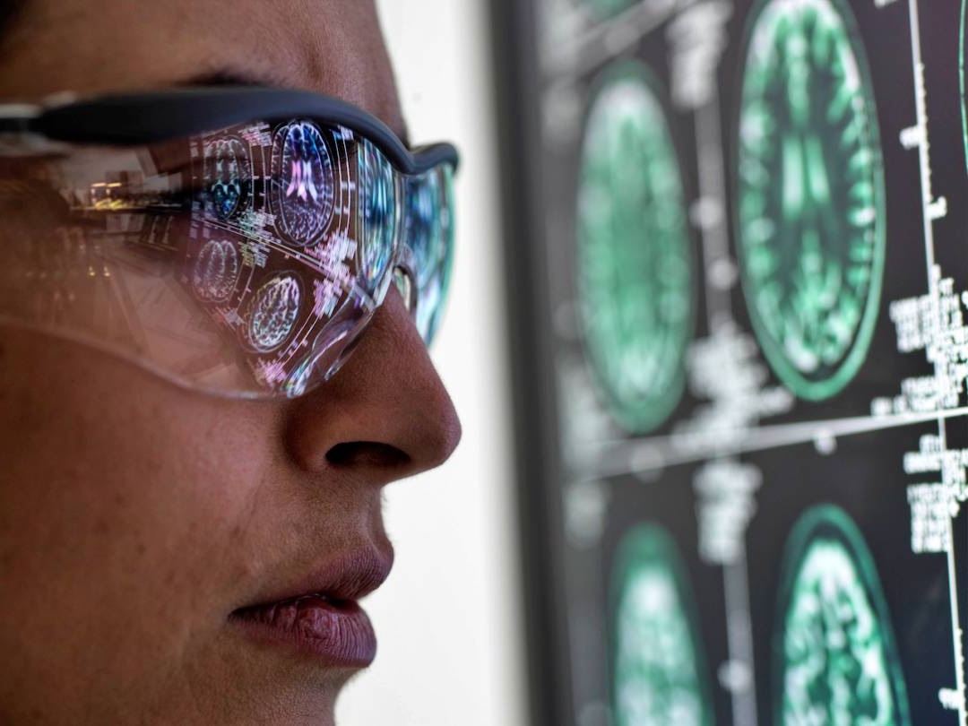 Close of up researcher wearing lab glasses and looking at a human brain scan.