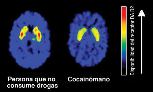 Apellido terciopelo Agnes Gray Cuáles son los efectos a largo plazo del uso de la cocaína? | National  Institute on Drug Abuse (NIDA)