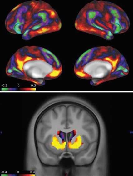 Estas son imágenes escaneadas del cerebro de un niño que muestran los cambios que ocurren cuando el niño logra una recompensa. Las zonas del cerebro que están más activas se destacan en rojo y amarillo.