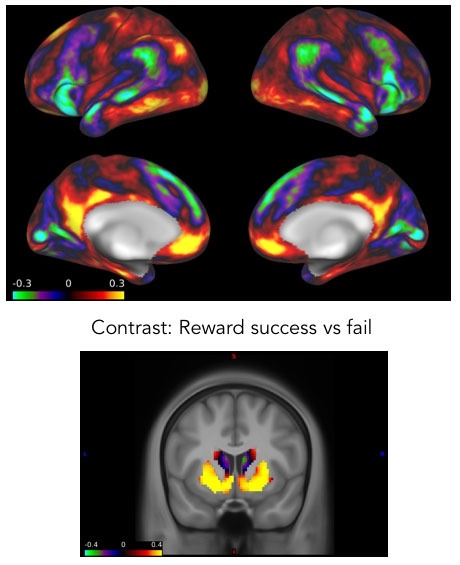 Graphics of brain scans showing the changes that happen in the brain when a child is successful at achieving a reward. Areas of the brain that are most active are highlighted in red and yellow.