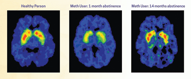 Drug Rehab Charlotte<br>Drug Detox<br>Alcohol Rehab<br>Alcohol Detox<br>Outpatient Detox