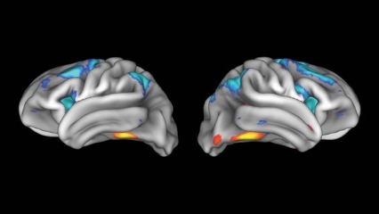 Combining results from 628 children's brains, this MRI scan shows regions activated as faces are viewed (yellow and orange) and other areas (blue and cyan) activated during a demanding working memory task.