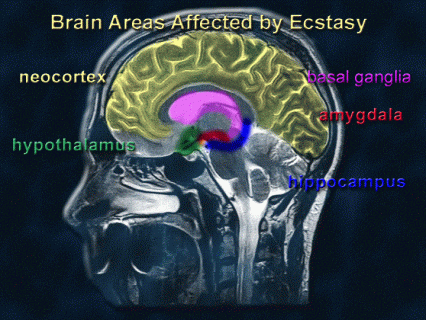 See text - Illustration of brain