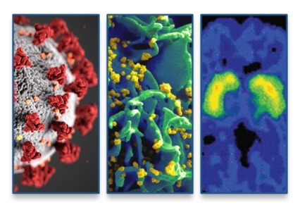 Image shows microscopic viral molecules for Covid-19, HIV, as well as an image of a brain of a person with a substance use disorder