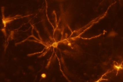 A mouse neuron in the striatum imaged using a two-photon optical microscope allows researchers to measure changes to dendritic spines and their influence on addiction.