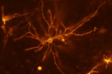  Una neurona de ratón en el cuerpo estriado obtenida con un microscopio óptico de dos fotones permite a los investigadores medir los cambios en las espinas dendríticas y su influencia en la adicción.