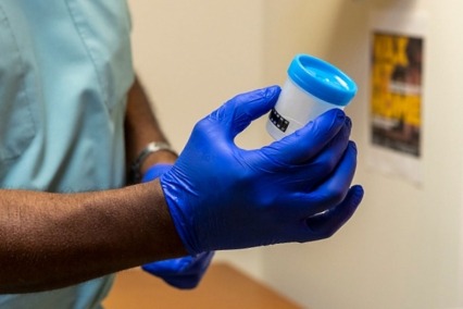 A photo of a medical professional wearing latex gloves and holding a specimen cup 