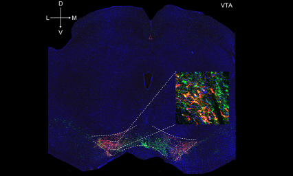 Imagen transversal de un cerebro que ilustra el área tegmental ventral donde las neuronas dopaminérgicas expresan el virus excitatorio
