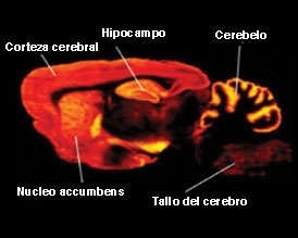 Es verdad que la marihuana actual es mucho más potente que la de