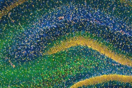 Rat Hippocampus