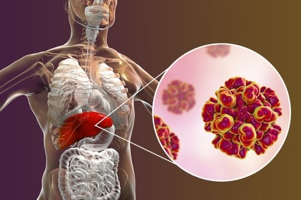 Digital image of Hepatitis E viral infection