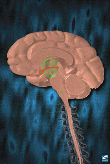Brain regions mediating the development of morphine dependence