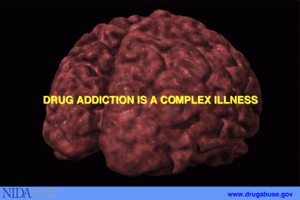 Drug Addiction is a complex illness