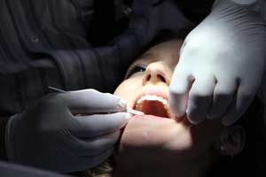 Dental repairs