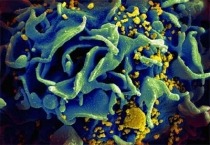 Image of an HIV-infected T cell