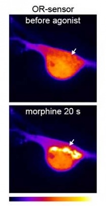 Fluorescence micrograph of a neuronal cell body showing the location of opioid receptor activation detected by the new biosensor immediately before (top panel) and 20 seconds after (bottom panel) application of morphine. Arrow points to the Golgi apparatus, a location within the interior of the cell body at which receptors are activated by morphine (as well as number of other non-peptide opioid drugs) but not by peptide ligands.