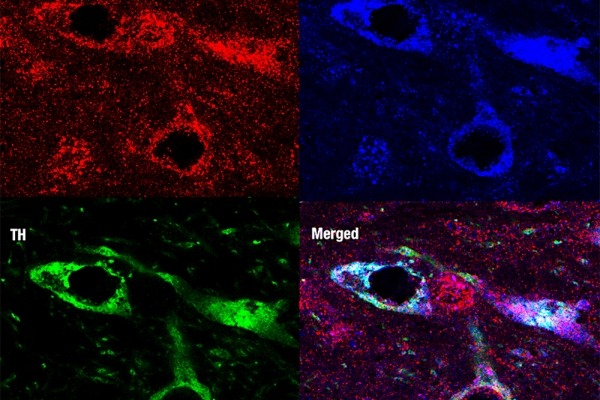 Chemical dyes identify key proteins for assembly and release of extracellular vesicles and dopamine synthesis in nerve cells in the mouse brain.