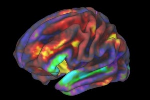 fMRI image of preteen brain while child performs a working memory task, released by ABCD researchers. The regions in yellow and red are most active.