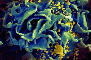 Image of an HIV-infected T cell