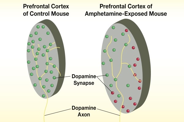 Exposure to Amphetamine Alters Dopamine Axons and Reduces the Density of Dopamine Synapses in the Prefrontal Cortex In control mice, dopamine axons form a large number of closely spaced synapses (green circles) in the prefrontal cortex. In amphetamine-exposed mice, dopamine synapses are sparser and more widely dispersed (red circles)