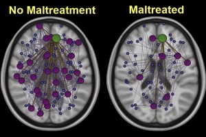 Imágenes escaneadas de dos cerebros con las etiquetas “Sin maltrato” y “Con maltrato” 