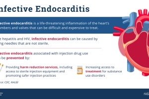 Basic information on infective endocarditis and injection drug use
