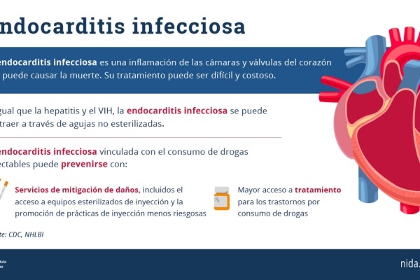 Esta gráfica contiene información básica sobre la endocarditis infecciosa, junto a una imagen anatómica de un corazón humano.