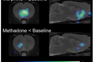 PET scan images in rats showing a much weaker ability of methadone than morphine to influence metabolic activity in the area of the nucleus accumbens. 