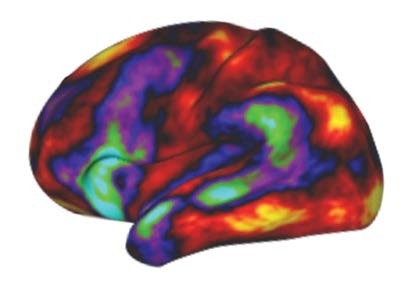Human brain x-ray 3D illustration.